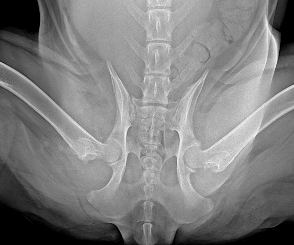 Radiografia de pelve