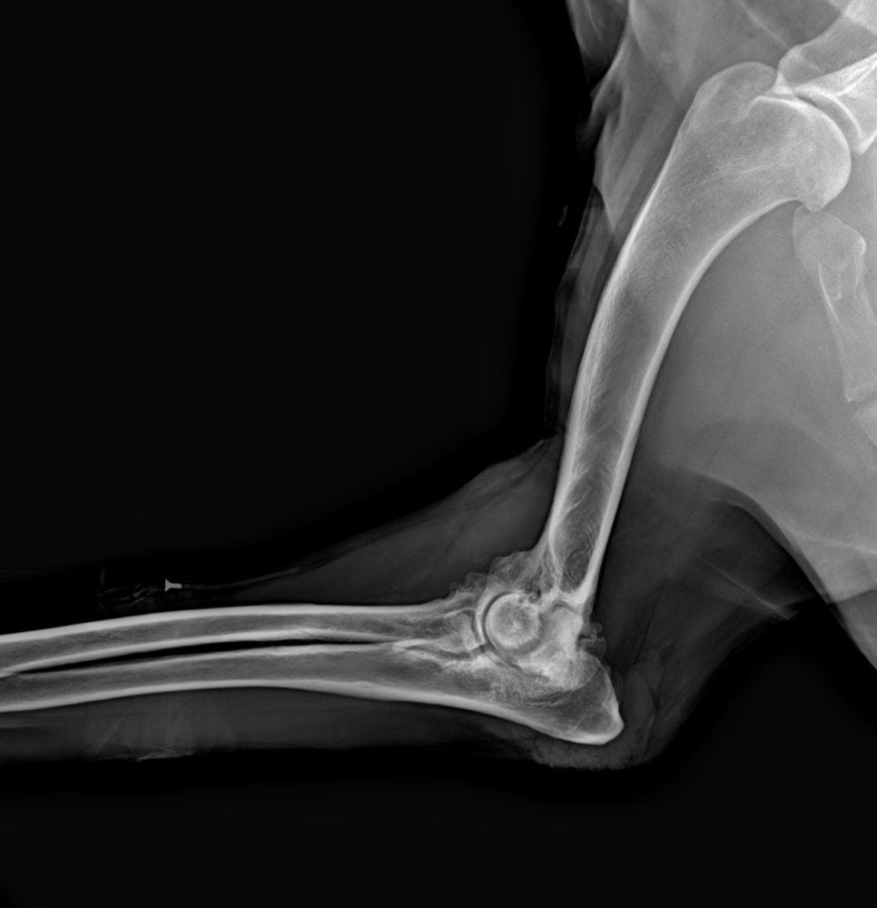 Radiografia de cotovelo
