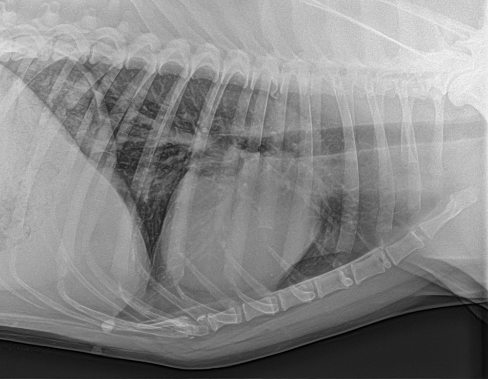 Radiografia de tórax, vista lateral