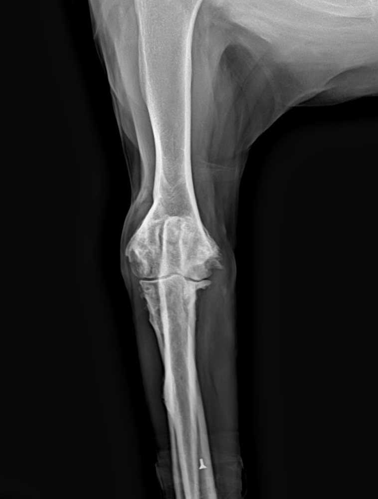Radiografia de articulação do joelho