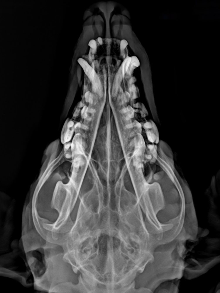 Radiografia de crânio, vista dorsoventral