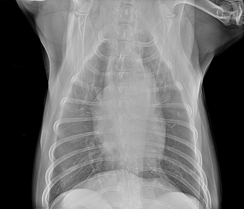 Radiografia de tórax, vista ventrodorsal